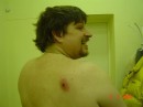 NASTY NASTY BITE ON DAVES BACK OOOCH! 194 * 448 x 336 * (14KB)